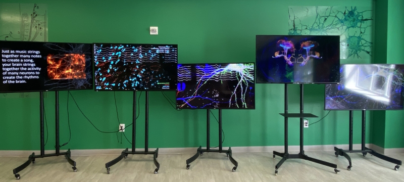 Five monitors on tall stands arranged in front of a green wall. Each monitor shows different graphics related to neural activity.